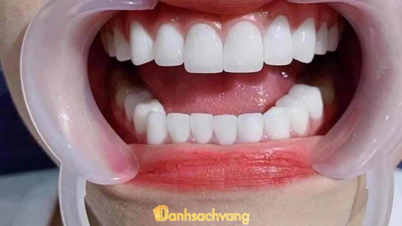 Hình ảnh NHA KHOA MỸ ĐỨC: 68 Nguyễn Văn Linh, TT. Sơn Tịnh, Quảng Ngãi