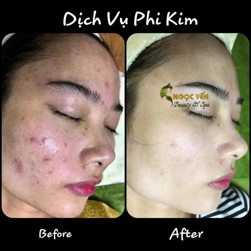 Hình ảnh Spa Ngọc Yến: 180a Đ. Chùa Hàng, Lê Chân, Hải Phòng