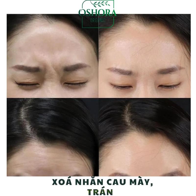 Hình ảnh Spa OSHORA:  96 Lãm Khê, Kiến An, Hải Phòng