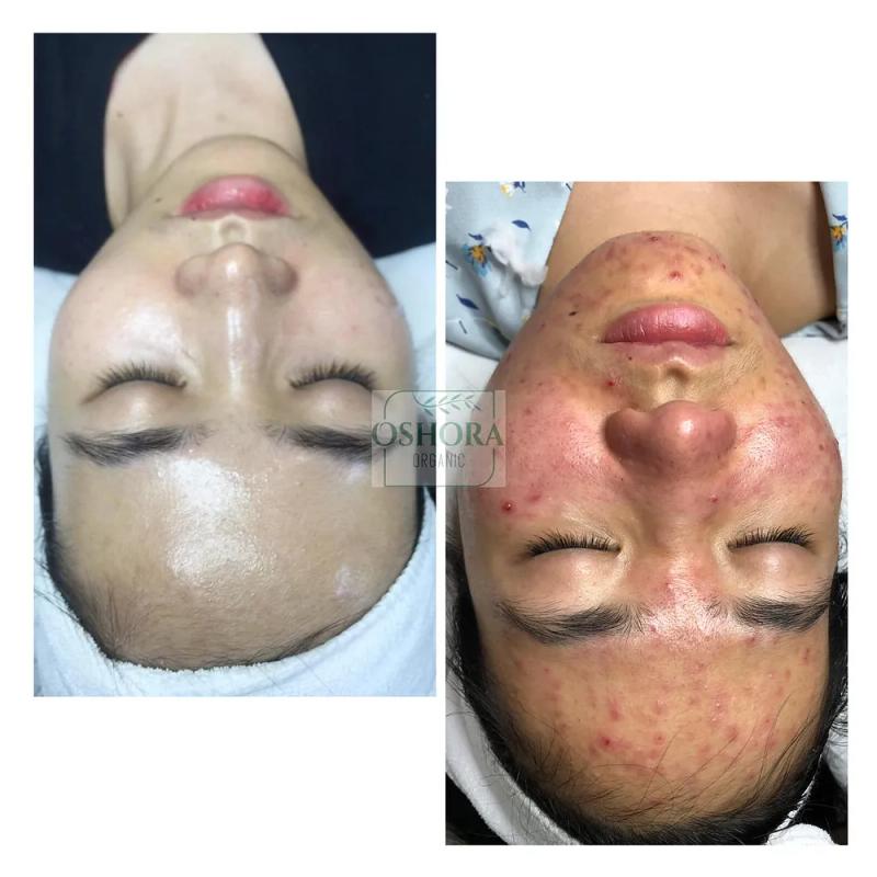 Hình ảnh Spa OSHORA:  96 Lãm Khê, Kiến An, Hải Phòng