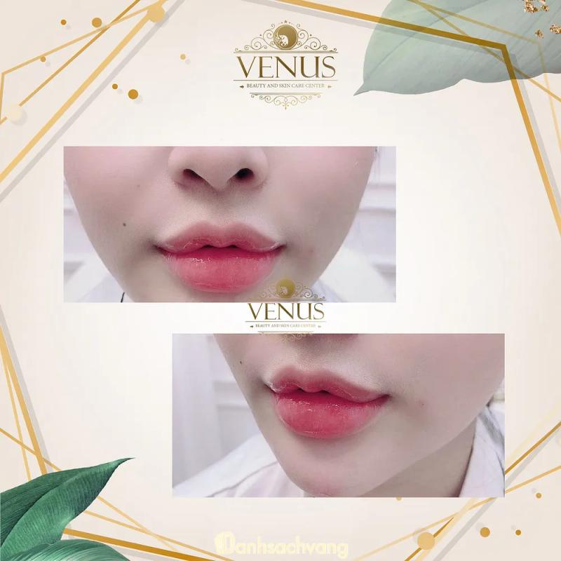 Hình ảnh VENUS SPA: 116 P. Cát Cụt, Lê Chân, Hải Phòng