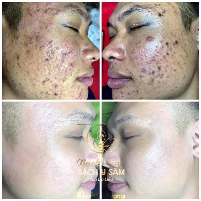 Hình ảnh Suri Spa: 74 Hoàng Ngọc Phách, Lê Chân, Hải Phòng