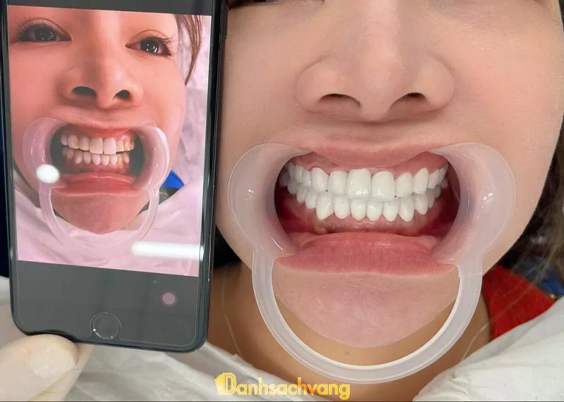 Hình ảnh Nha khoa Ngân Hoàng: 25+26 Trường Lạc, H. Diên Khánh