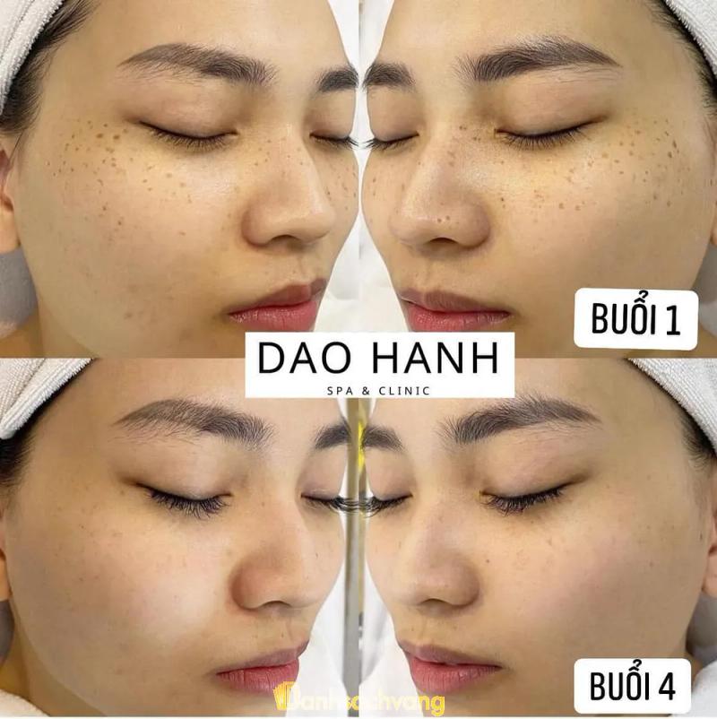 Hình ảnh Dao Hanh Spa: Đường P.Tô Hiến Thành, Từ Sơn, Bắc Ninh