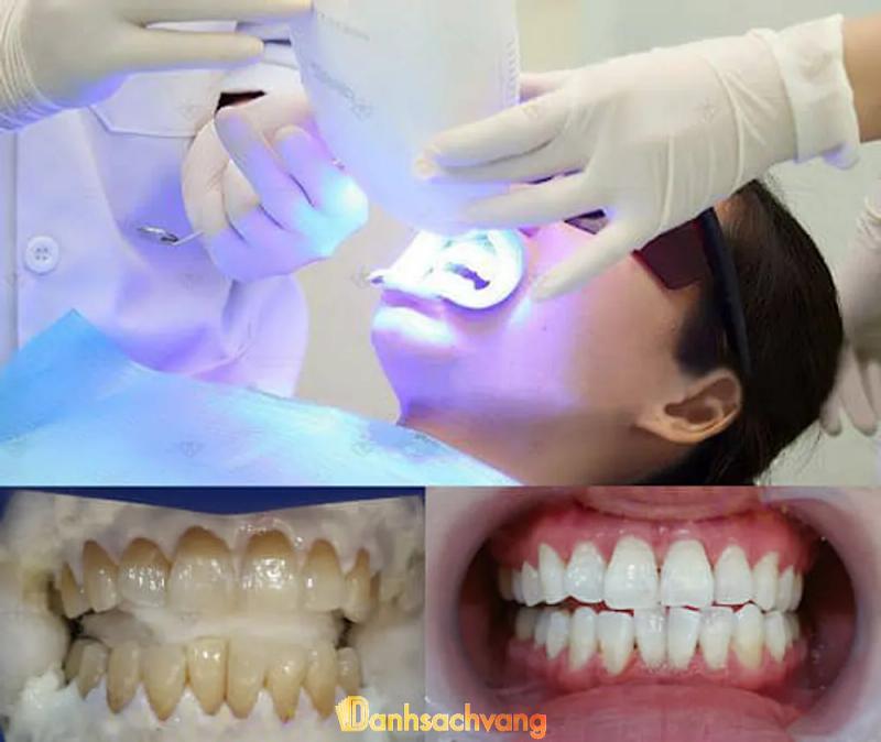 Hình ảnh Nha khoa Việt Mỹ: 183 Hùng Vương, H. Vạn Ninh