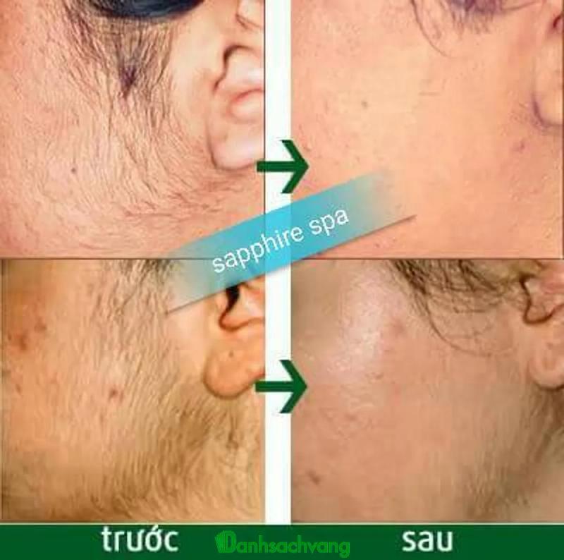 Hình ảnh Sapphire Spa Bắc Ninh: 114 Nguyễn Cao, Bắc Ninh