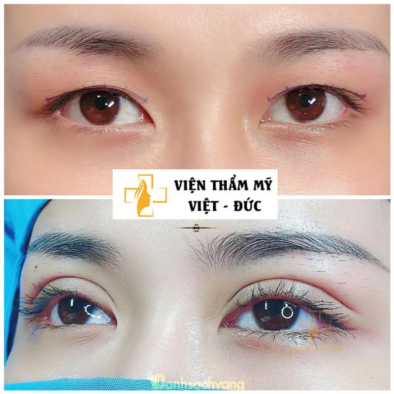 Hình ảnh Thẩm Mỹ Viện Quốc Tế Việt Đức Bắc Ninh: 309 Đ. Trần Phú, Từ Sơn, Bắc Ninh