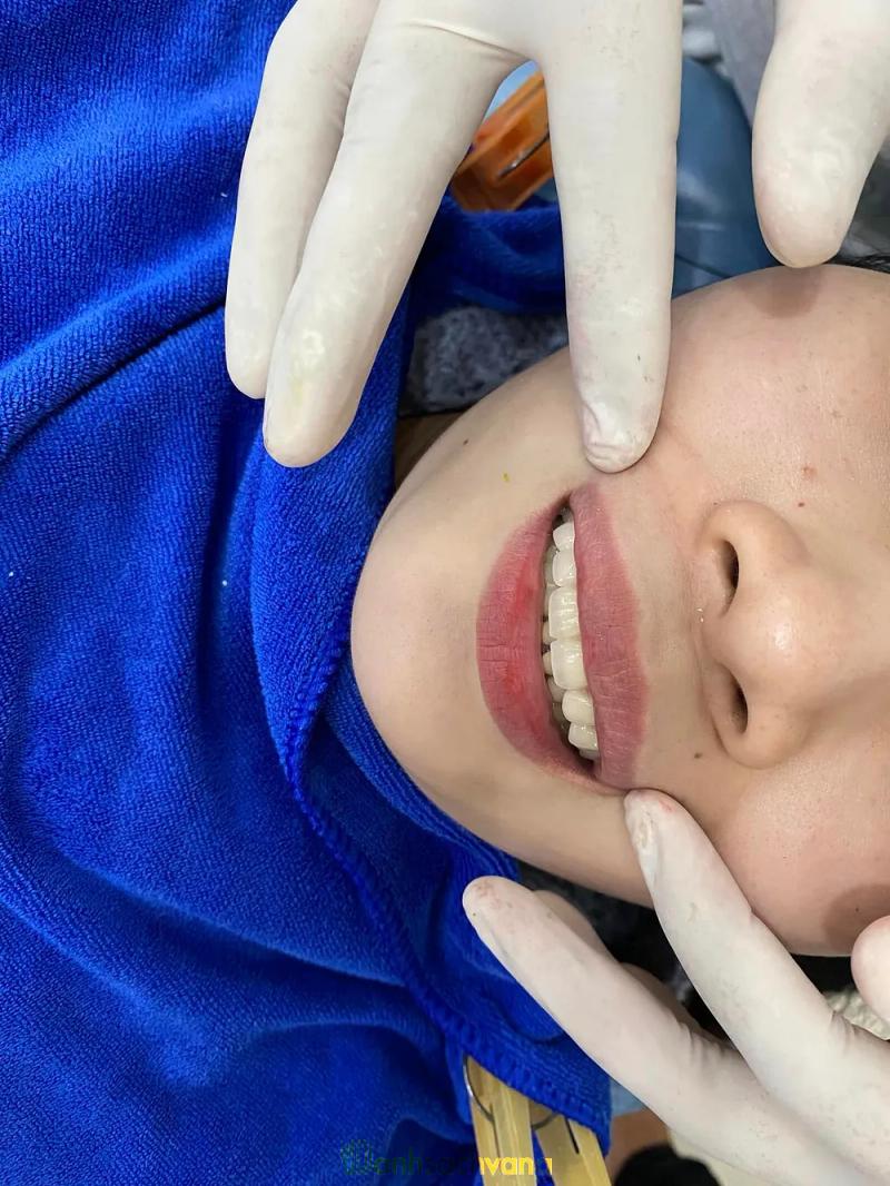 Hình ảnh Nha Khoa Quốc Tế P.T: 516 Trần Quý Cáp, TX. Ninh Hoà
