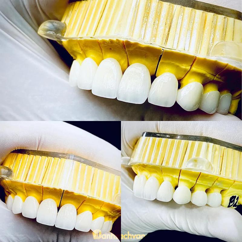 Hình ảnh Nha Khoa Quốc Tế P.T: 516 Trần Quý Cáp, TX. Ninh Hoà