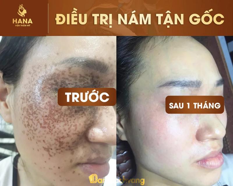 Hình ảnh Viện Thẩm Mỹ Hana: 592 Nguyễn Trãi, Bắc Ninh