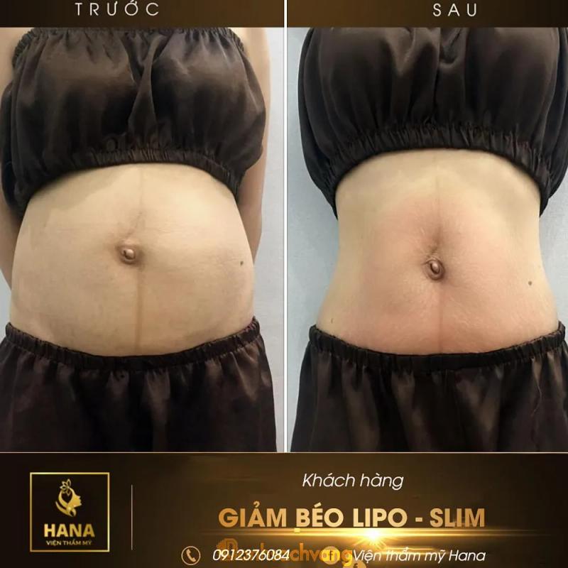 Hình ảnh Viện Thẩm Mỹ Hana: 592 Nguyễn Trãi, Bắc Ninh
