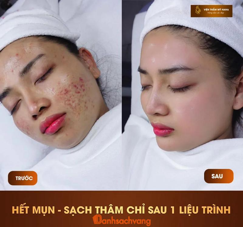 Hình ảnh Viện Thẩm Mỹ Hana: 592 Nguyễn Trãi, Bắc Ninh
