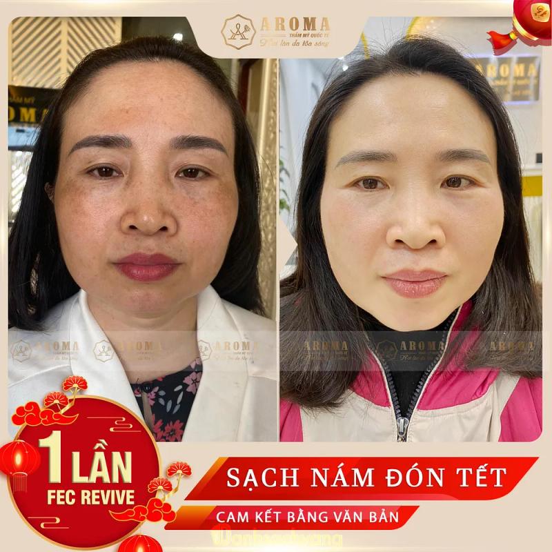 Hình ảnh Thẩm Mỹ AROMA Bắc Ninh: 39 Đỗ Trọng Vỹ, Bắc Ninh