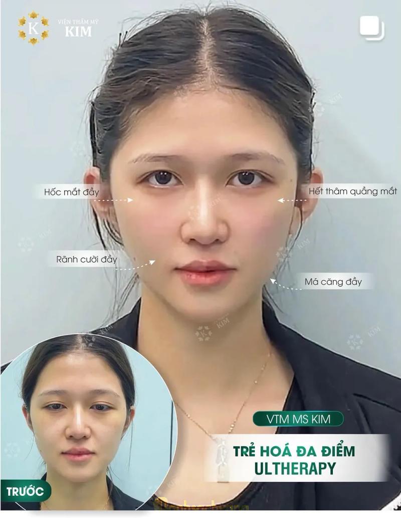 Hình ảnh Viện Thẩm Mỹ Ms.Kim: 150 Nguyễn Gia Thiều, Bắc Ninh