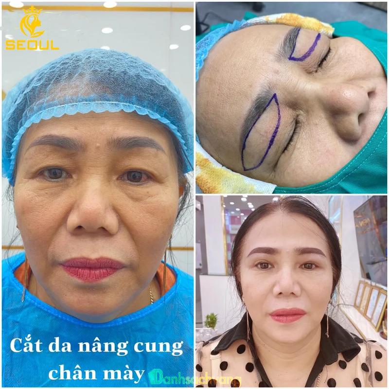 Hình ảnh Thẩm Mỹ Quốc Tế Seoul: 455 Nguyễn Trãi, Bắc Ninh