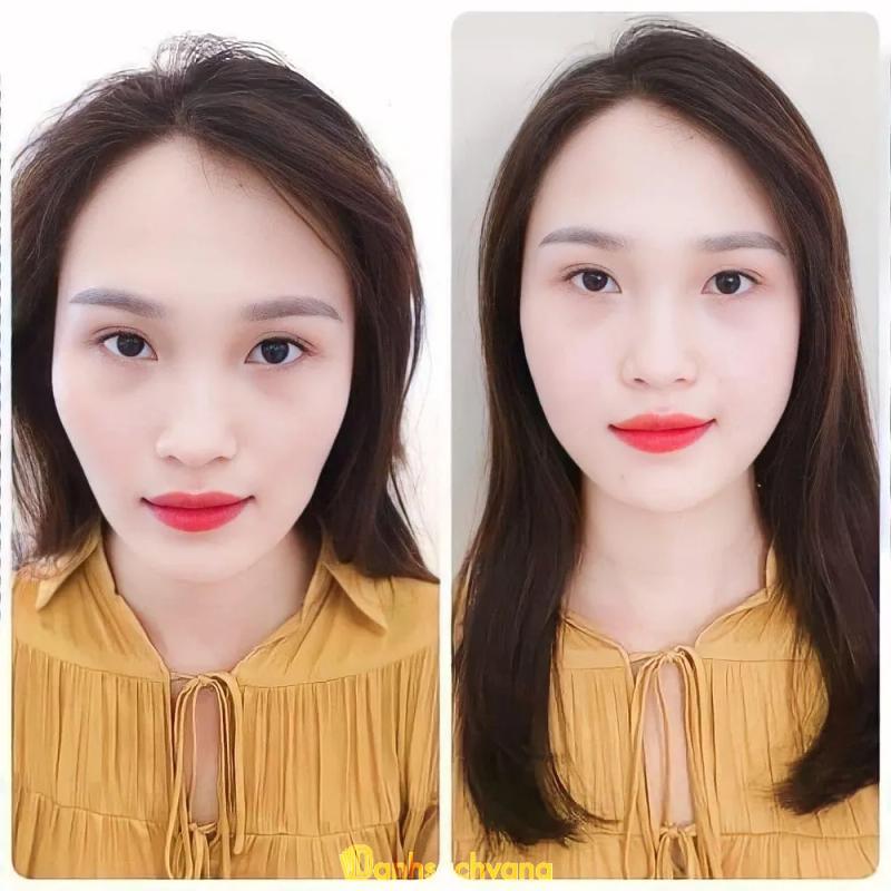 Hình ảnh Thẩm Mỹ Quốc Tế Seoul: 455 Nguyễn Trãi, Bắc Ninh