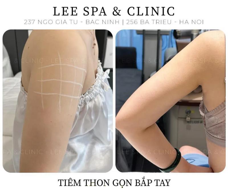 Hình ảnh Lee Spa Clinic: 237 Ngô Gia Tự, Bắc Ninh