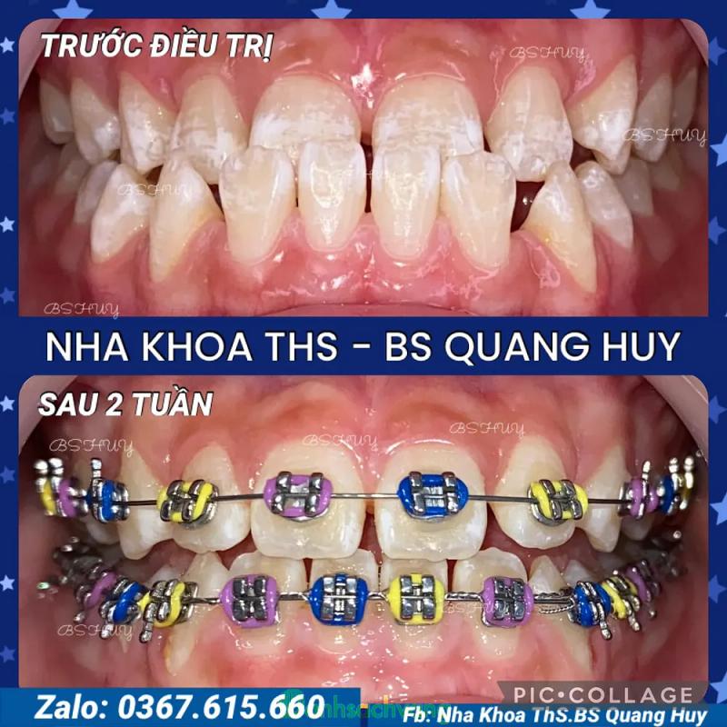 Hình ảnh Nha Khoa Thẩm Mĩ - Niềng Răng Thạc Sĩ Bác Sĩ Quang Huy: 222 Ba Tháng Hai, H. Đức Linh