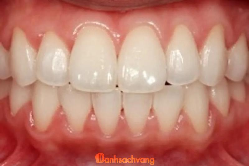 Hình ảnh Nha Khoa Nụ Cười Mới: 160 QL28, H. Hàm Thuận Bắc