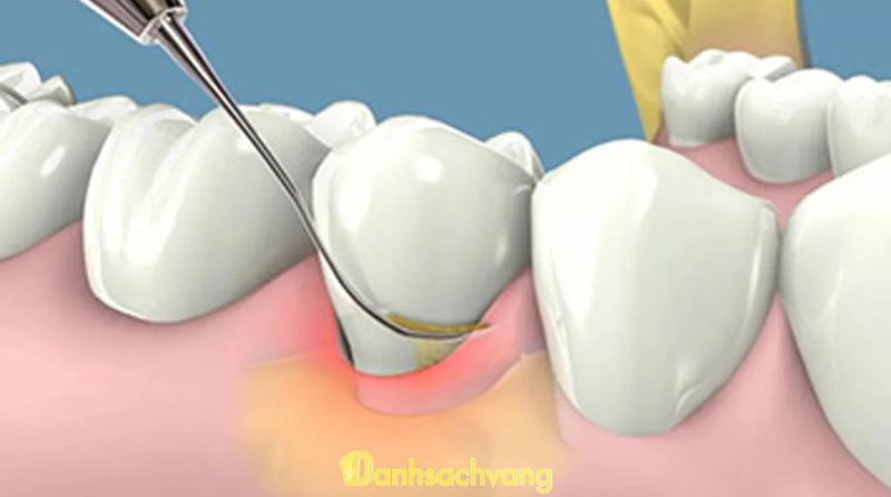 Hình ảnh Nha Khoa Quốc Tế: 77 Võ Thị Sáu, H. Tuy Phong