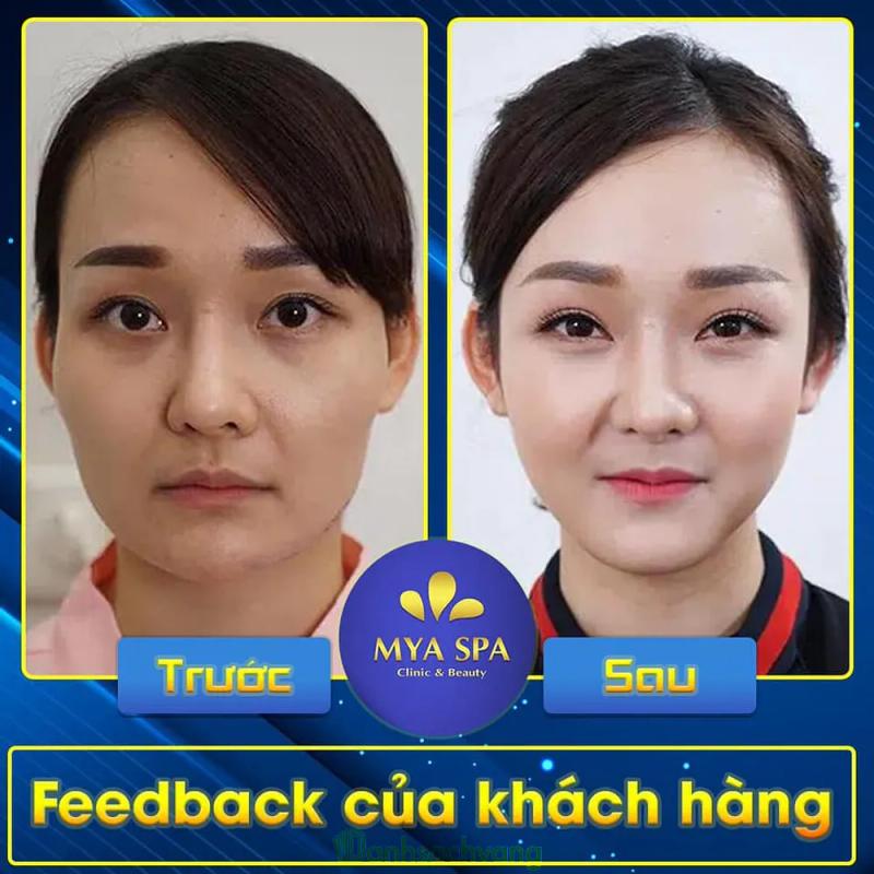 Hình ảnh THẨM MỸ VIỆN MYA: 154 Đ. Kinh Dương Vương, Bắc Ninh
