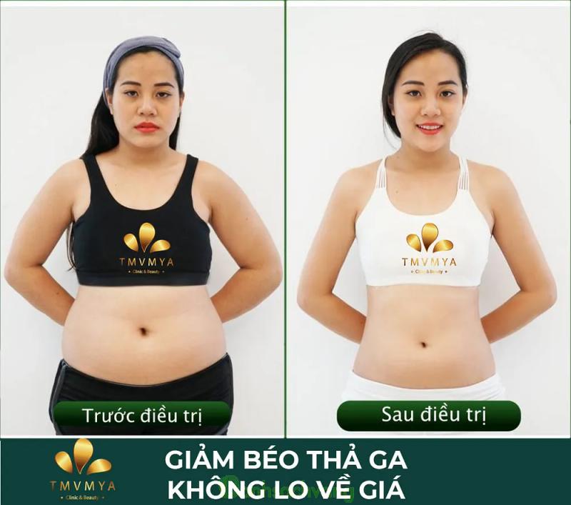 Hình ảnh THẨM MỸ VIỆN MYA: 154 Đ. Kinh Dương Vương, Bắc Ninh