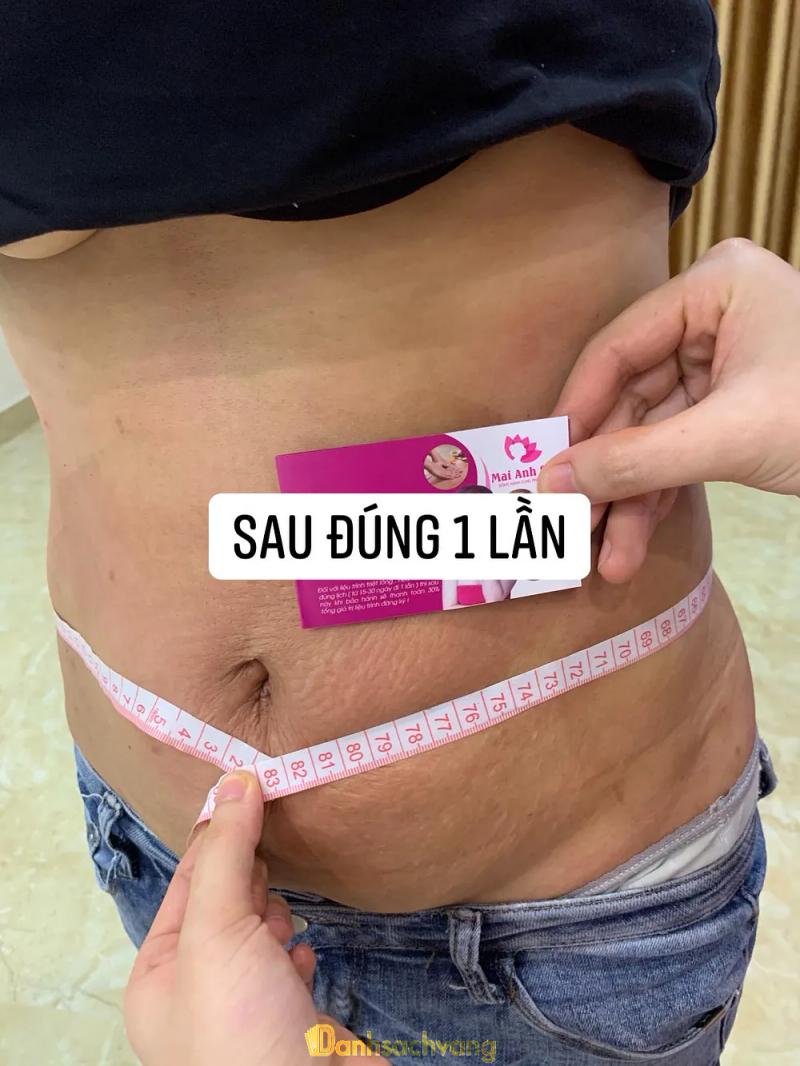 Hình ảnh Mai Anh Spa: 53FF+V27, Nguyễn Đăng Đạo,  Bắc Ninh