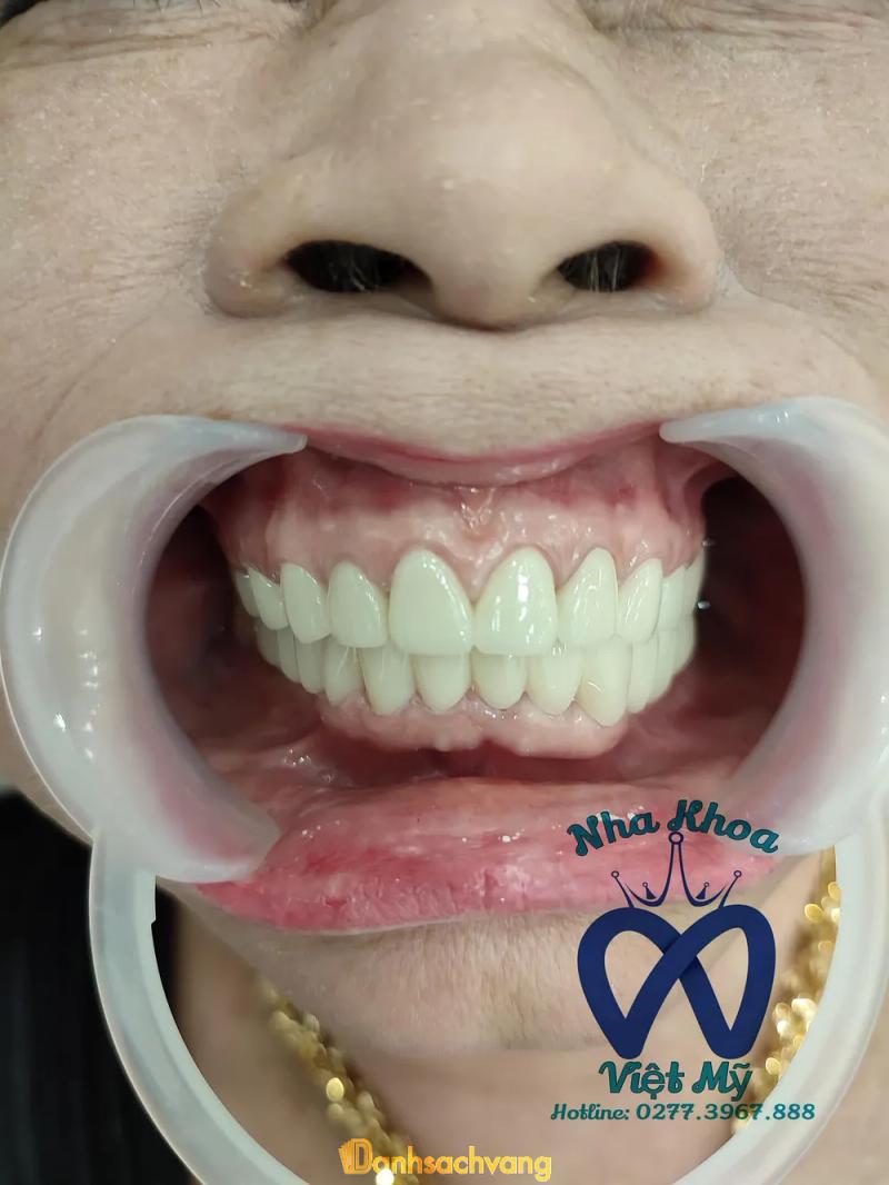 Hình ảnh Nha khoa thẩm mỹ Việt Mỹ: 2 Lê Lợi, TP. Hồng Ngự