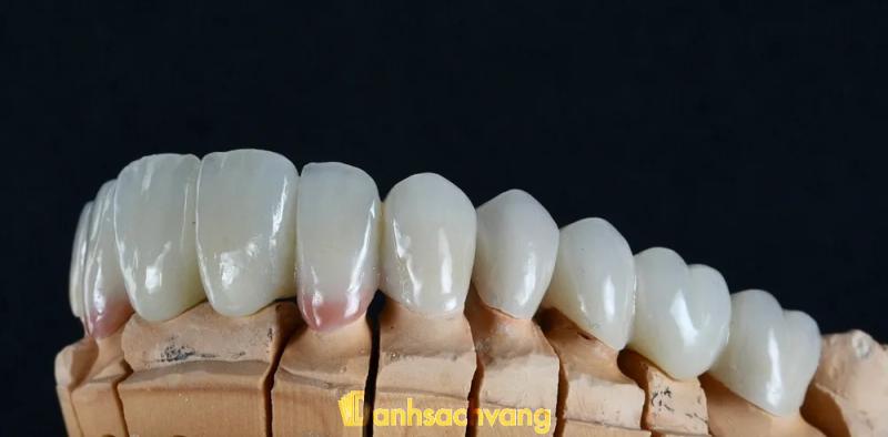 Hình ảnh Nha khoa Hạnh Phúc - Sa Đéc: 1 ĐT 848, TP. Sa Đéc