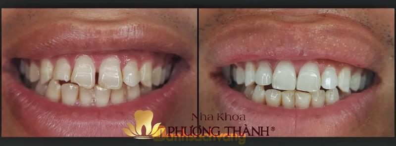 Hình ảnh Nha khoa Phương Thành: 483 Hùng Vương, TP. Sa Đéc
