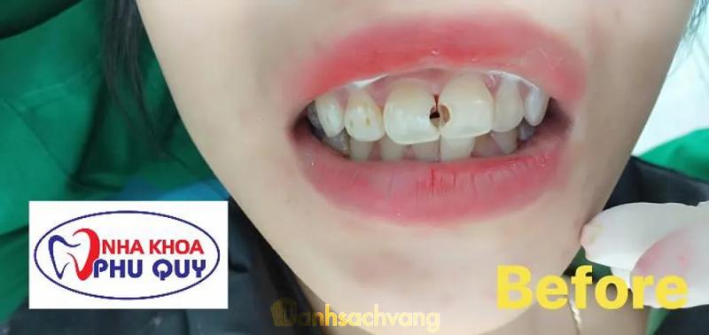 Hình ảnh Nha khoa Phú Qúy: 8 Huỳnh Phước, H. Ninh Phước