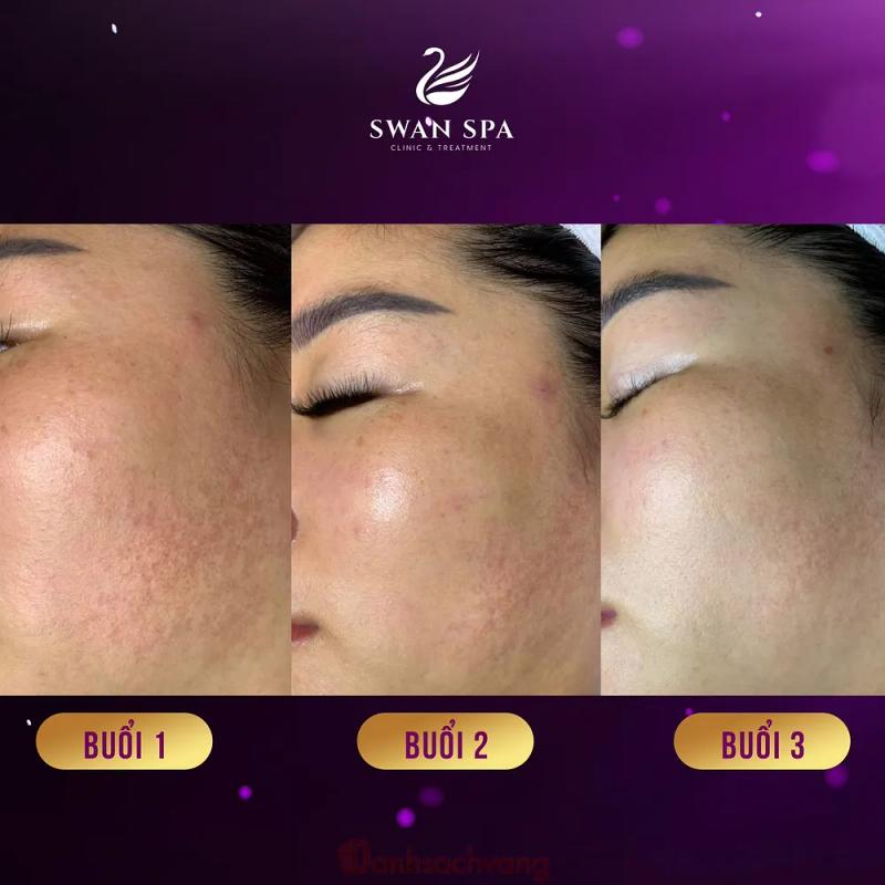 Hình ảnh Swan Spa: 38 Lê Lợi, Vĩnh Yên, Vĩnh Phúc