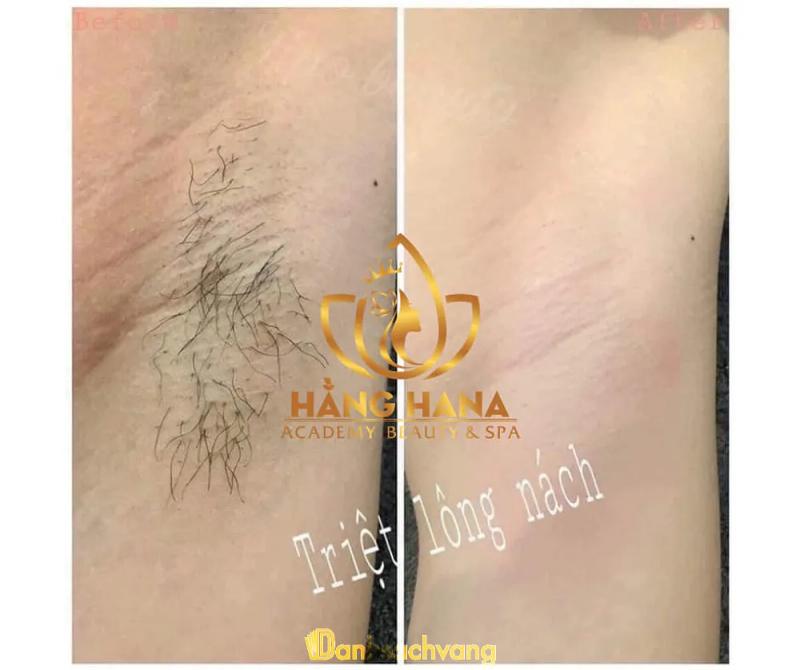 Hình ảnh Spa Hằng Hana: 12 Nguyễn Trãi, Vĩnh Yên, Vĩnh Phúc