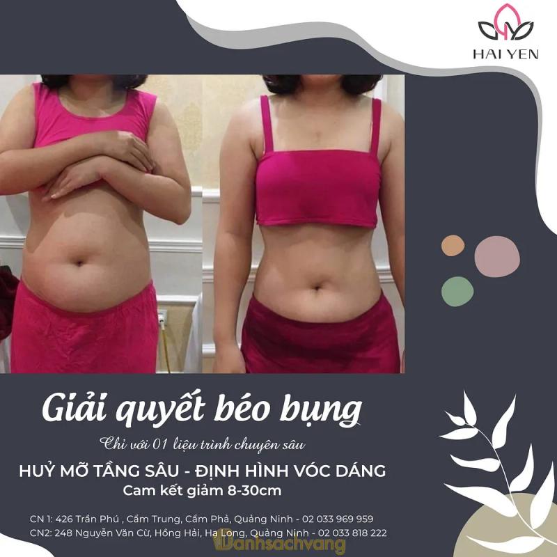 Hình ảnh Hải Yến spa: 1 Hải Vân, TP. Hạ Long, Quảng Ninh
