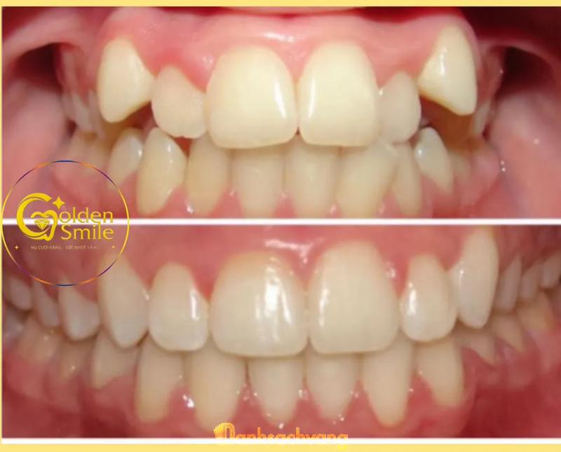 Hình ảnh Nha khoa Thẩm Mỹ Golden Smile: Xóm1, H. Đức Trọng