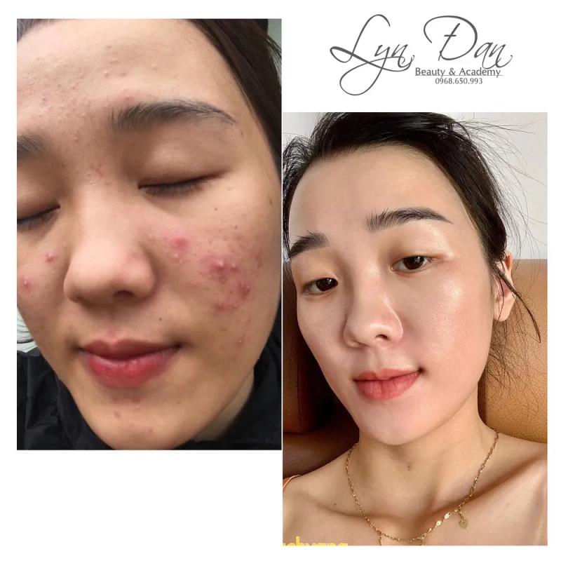 Hình ảnh LYN ĐAN SPA: 435 Lê Thanh Nghị, TP. Hải Dương