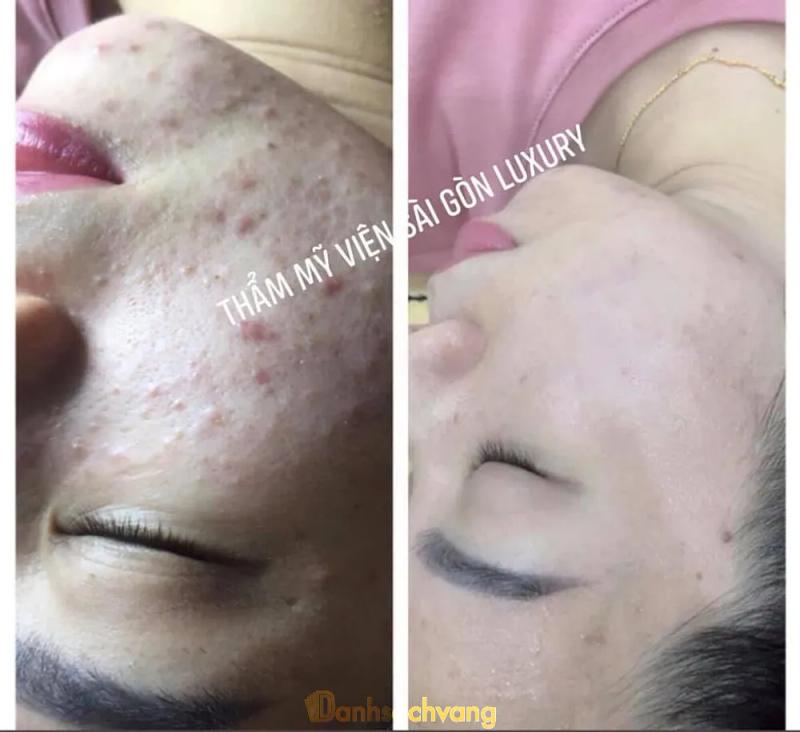 Hình ảnh Saigon Luxury Spa: 112 Thống Nhất, TP. Hải Dương,