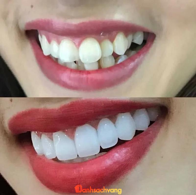 Hình ảnh Nha khoa Bảo Anh:  476 QL 20, H. Đức Trọng