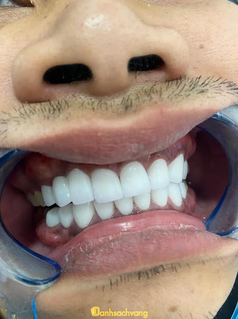 Hình ảnh Nha Khoa Việt Đức: TDP 8, H. Cát Tiên