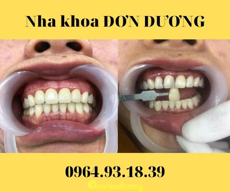 Hình ảnh Nha khoa Đơn Dương: 322 - 2/4, H. Đơn Dương