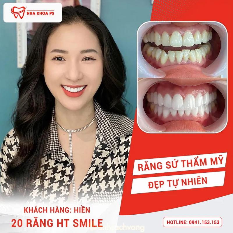 Hình ảnh Nha khoa PS: 293A - 2/4, H. Đơn Dương