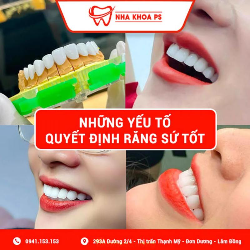 Hình ảnh Nha khoa PS: 293A - 2/4, H. Đơn Dương