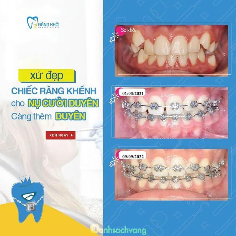 Hình ảnh Nha khoa Đăng Khôi: 790 Hùng Vương, H. Di Linh