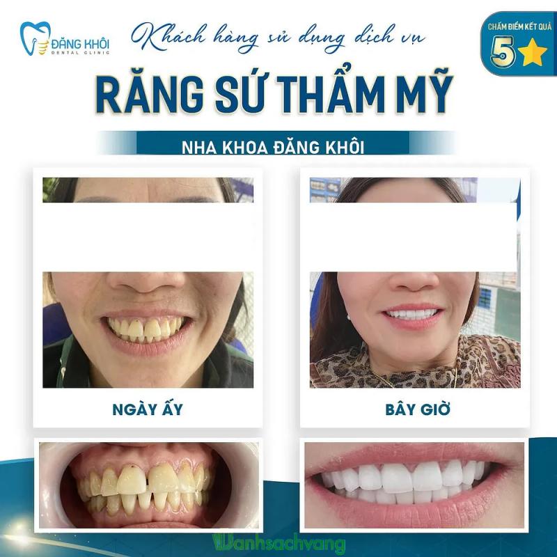 Hình ảnh Nha khoa Đăng Khôi: 790 Hùng Vương, H. Di Linh