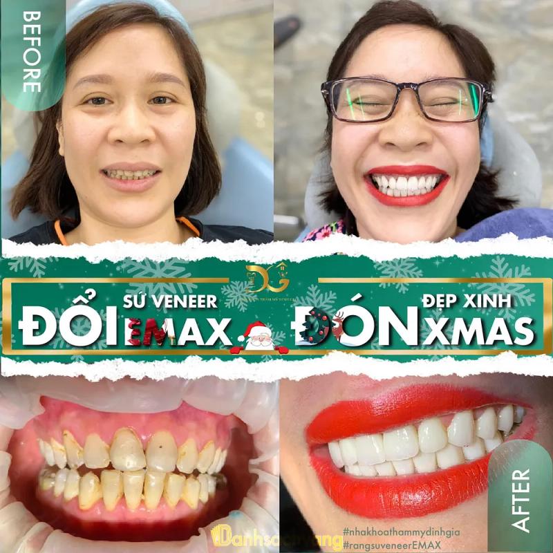 Hình ảnh Nha khoa Đinh Gia Tân Hà: Ấp Liên Trung, H. Lâm Hà