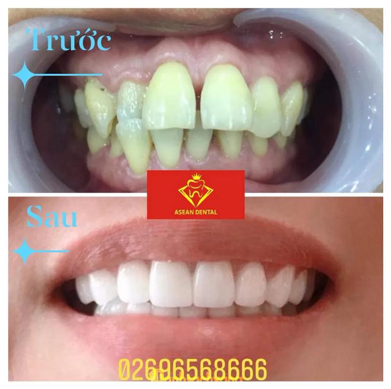 Hình ảnh Nha khoa Đông Nam Á: 1025 Quang Trung, TX. An Khê