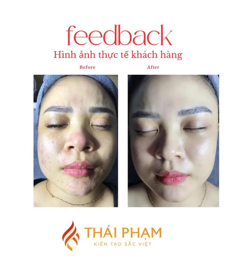 Hình ảnh Thẩm Mỹ Thái Phạm: 113 Đ. Lý Tự Trọng, Tp. Vinh, Nghệ An