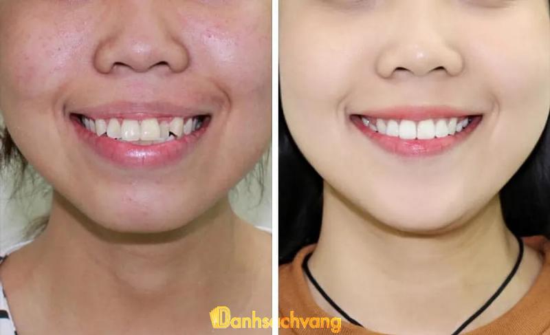 Hình ảnh Nha khoa Việt Mỹ: 66 Lê Hồng Phong, TX. AyunPa