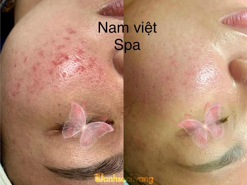 Hình ảnh Nam Việt Spa: 39 Đ. Lê Hồng Phong, TP. Vinh, Nghệ An