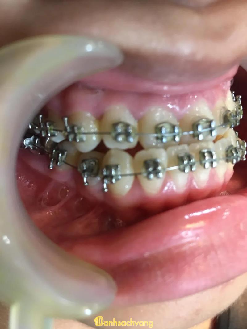 Hình ảnh Nha khoa Nụ Cười Mới: 70 Trần Hưng Đạo, TX. Ayun Pa